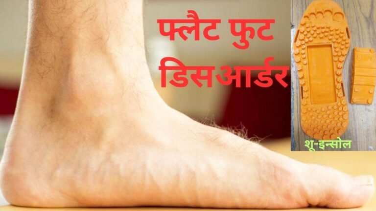 फ्लैट फुट डिसआर्डर के खतरे से बचाएगा एटीएल के बच्चों का नवाचार