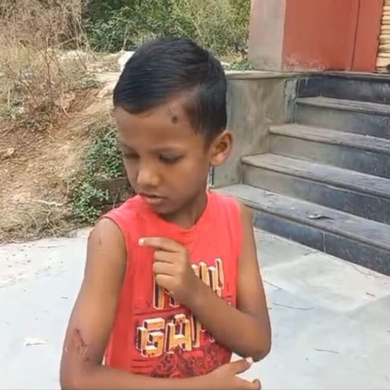 कुत्ते ने बच्चे पर किया हमला, बुजुर्ग ने बचाया: VIDEO:अंबिकापुर में आवारा कुत्तों का आतंक, झुंड में लोगों को बना रहे शिकार