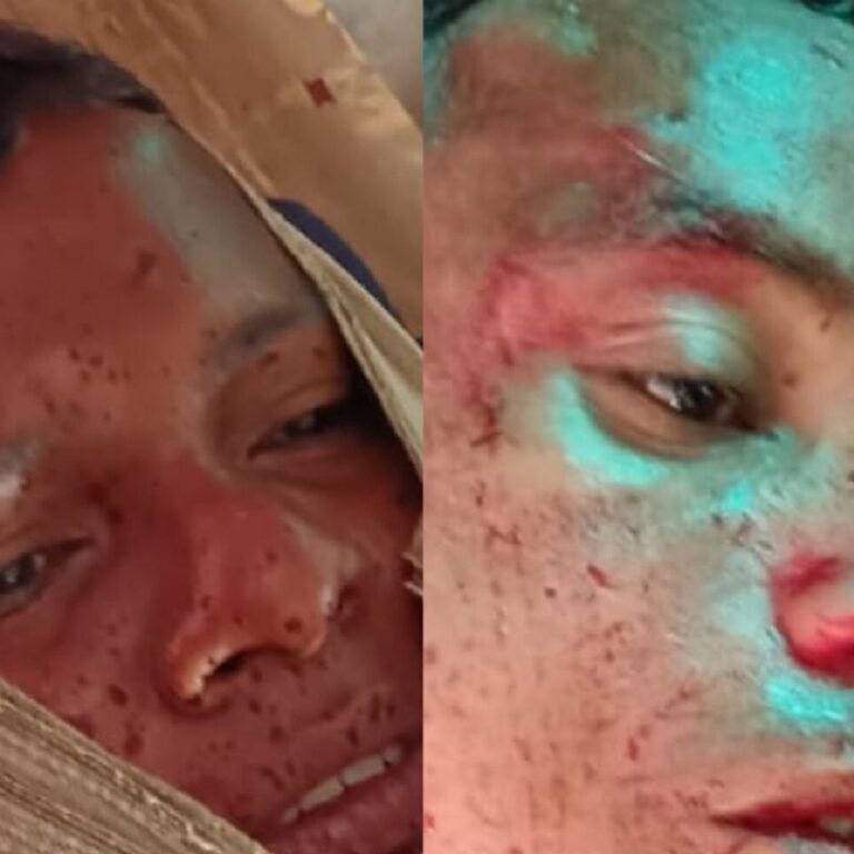 जगरगुंडा के साप्ताहिक बाजार में नक्सली हमला:दो जवानों पर चाकू से किया वार, हथियार लूटकर भागे; रायपुर एयरलिफ्ट किए गए दोनों