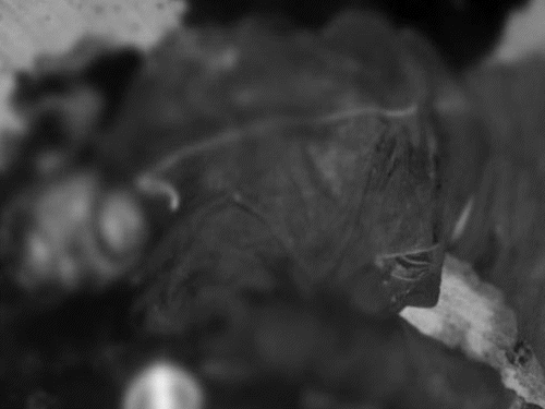 दूसरी शादी करूंगा कहने पर पति को कुल्हाड़ी से काटा:बच्चा नहीं होने पर पत्नी से करता था विवाद, चेहरे-सिर पर 3-4 बार वारकर भागी