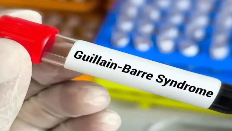 Guillain-Barre syndrome: खंडवा के व्यक्ति में जीबीएस की आशंका, इंदौर में इलाज के लिए भर्ती