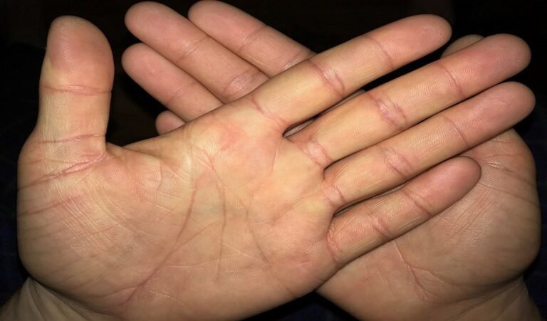 Palmistry Tips: हथेली पर है ये निशान तो किस्मत के धनी हैं आप, समाज में मिलेगी मान-प्रतिष्ठा