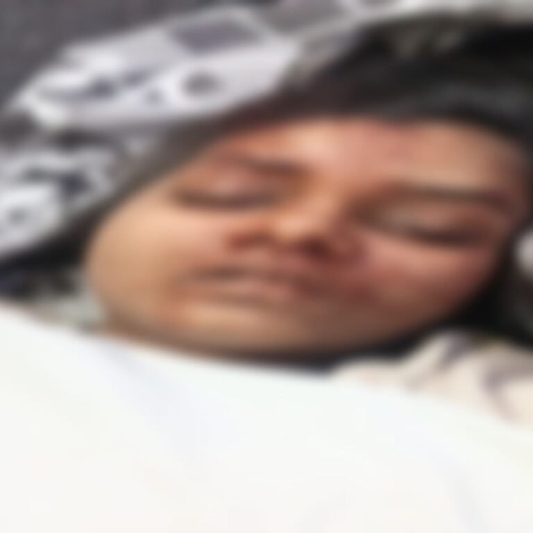 रायपुर में 11 माले की बिल्डिंग से गिरी लड़की:सिर फटने से मौत, हत्या या आत्महत्या, मौके पर पुलिस की टीम जांच में जुटी