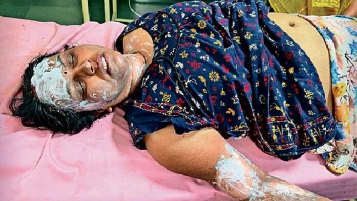 Ladies Tailor Shivpuri: शिवपुरी में सिलाई के पैसों के विवाद में महिला टेलर ने पार्षद पर पेट्रोल छिड़ककर लगा दी आग