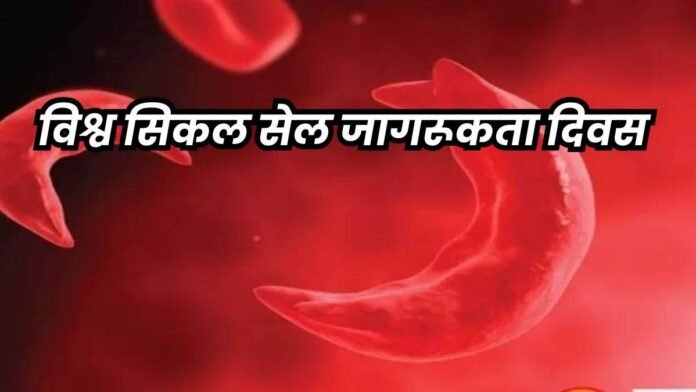 मध्य प्रदेश में दो लाख से अधिक लोग मिले जो सिकल सेल पीड़ित बच्चों को दे सकते थे जन्म
