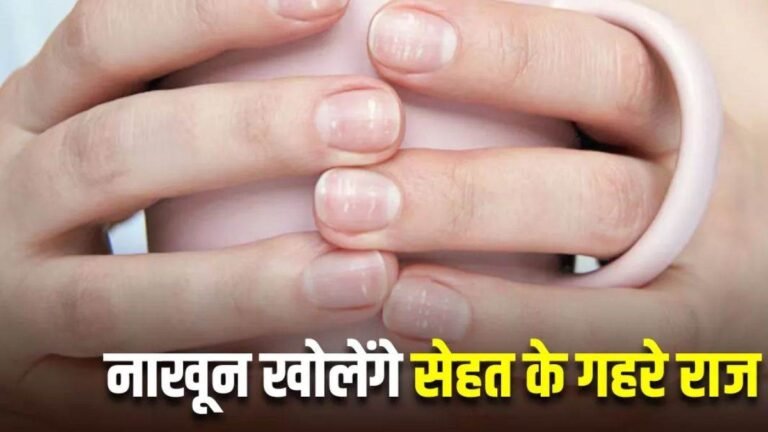 नाखून बताते हैं आपके सेहत का हाल, इन 10 Warning Signs पहचानना है बेहद जरूरी