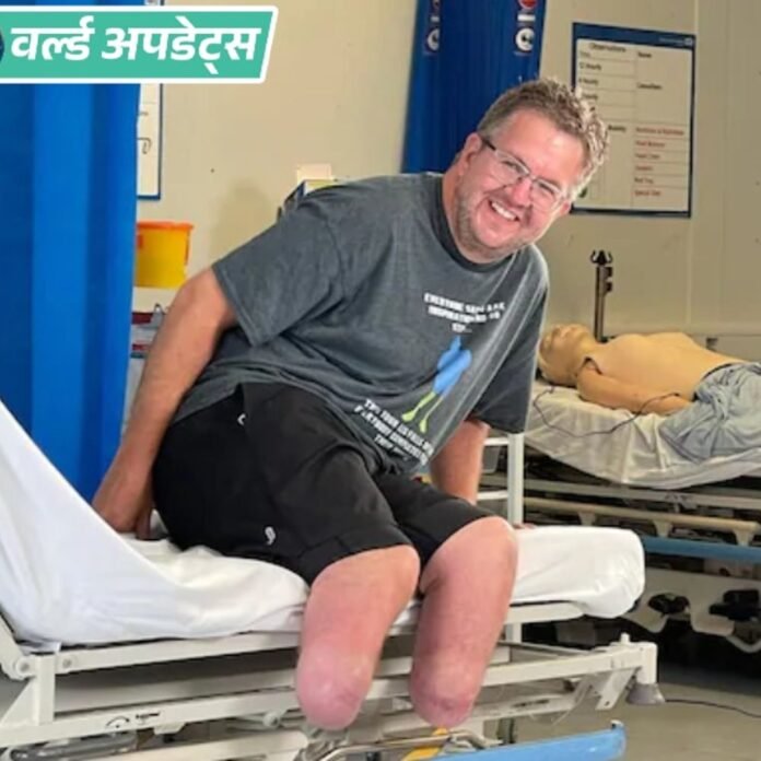 वर्ल्ड अपडेट्स:ब्रिटिश सर्जन पर ₹5.4 करोड़ बीमा पाने के लिए खुद की टांगें काटने का आरोप