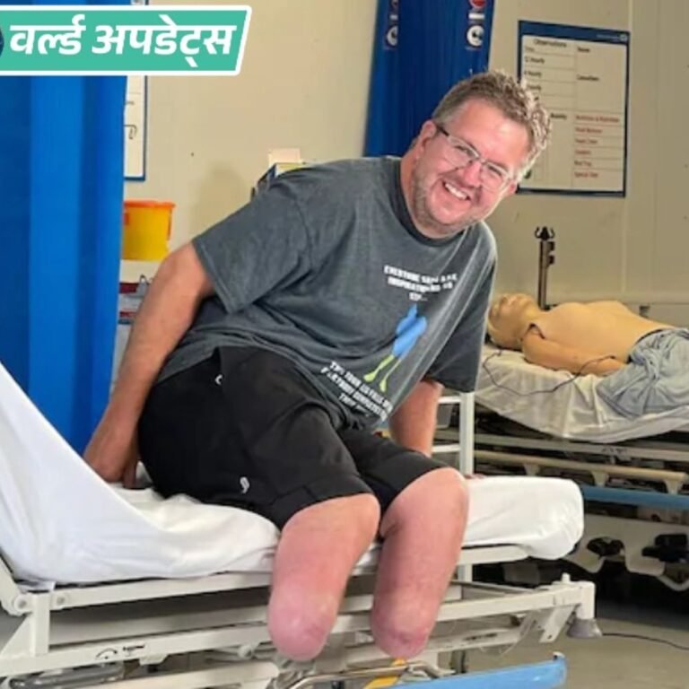 वर्ल्ड अपडेट्स:ब्रिटिश सर्जन पर ₹5.4 करोड़ बीमा पाने के लिए खुद की टांगें काटने का आरोप