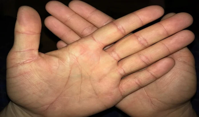 Palmistry Tips: हथेली की ये रेखा बिगाड़ सकती है आपका भाग्य, जानिए क्या है इसका रहस्य