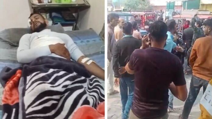 'अब चला नहीं जाता, मेरी पसलियां टूट गई हैं'... छोटी-सी कहा-सुनी पर पुलिस ने रात भर थाने में रखकर पीटा