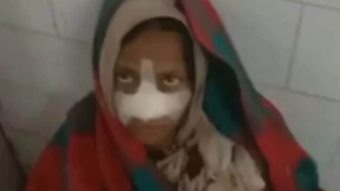 पति से पैसे मांगने पर सौतन ने किया जानलेवा हमला... महिला की काटी नाक