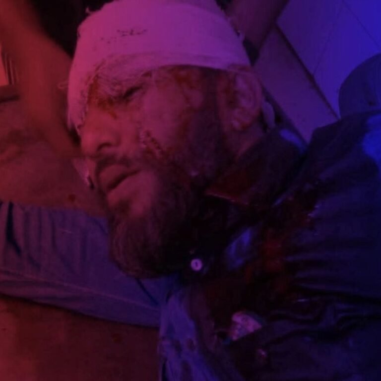 बांग्लादेश में हसीना विरोधी एक और नेता पर हमला:घर में घुसकर गोली मारी, कान के आर-पार निकली, हालत गंभीर