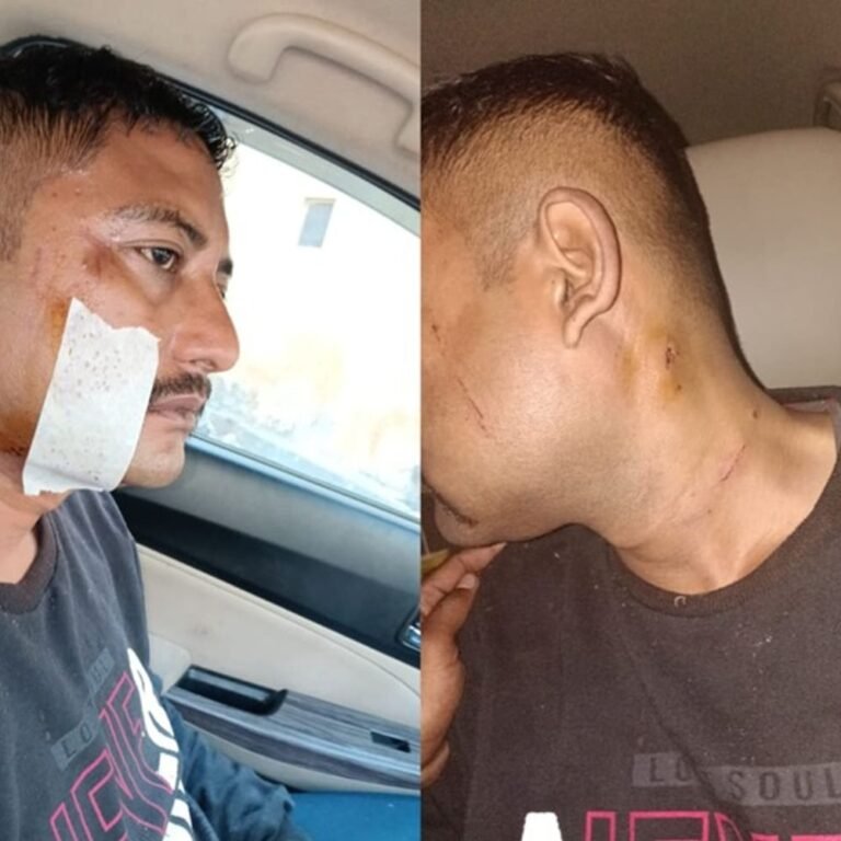 महिला टीचर ने ASI पति को जमकर पीटा:अंबिकापुर में नशे में धुत होकर पहुंचा था घर, बेटी को पीटने लगा,तो पत्नी ने की पिटाई