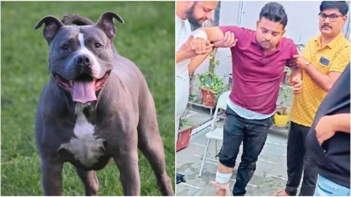 रायपुर में पेमेंट लेने पहुंचे युवक पर डॉक्टर के पिटबुल ने किया हमला, अब तक 5 से ज्यादा लोगों को कर चुका घायल