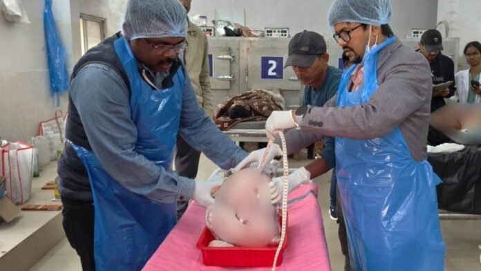 पोस्टमॉर्टम में चौंकाने वाला खुलासा, महिला के पेट से जो निकला उसे देख डॉक्टर भी रह गए हैरान, दे डाली चेतावनी