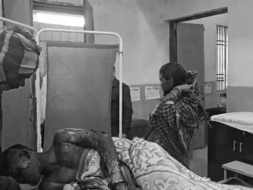 रायगढ़ के टायर प्लांट में ब्लास्ट…8 मजदूर 80% तक झुलसे:9 महीने की मासूम भी जख्मी, हालत नाजुक, टायर गलाने के दौरान हुआ विस्फोट