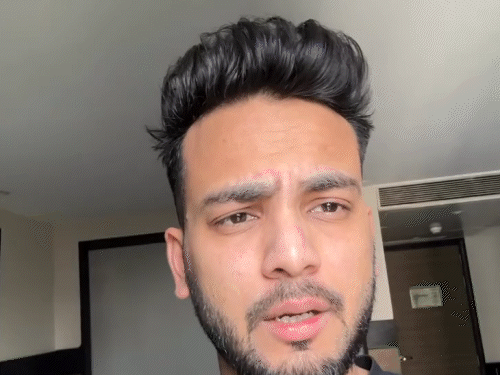 सुप्रीम कोर्ट की एल्विश यादव को फटकार:सांप के जहर मामले में वन्यजीव संरक्षण कानून उल्लंघन पर सख्त टिप्पणी, जांच रिपोर्ट पर अगली सुनवाई