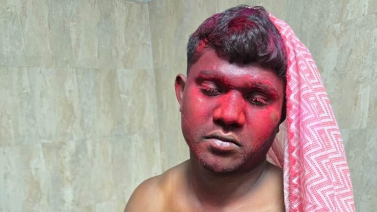 बाइक से गिरे युवक के सीने में धंसा बांस.. छह घंटे तक उसी हालत में इलाज के लिए भटकता रहा